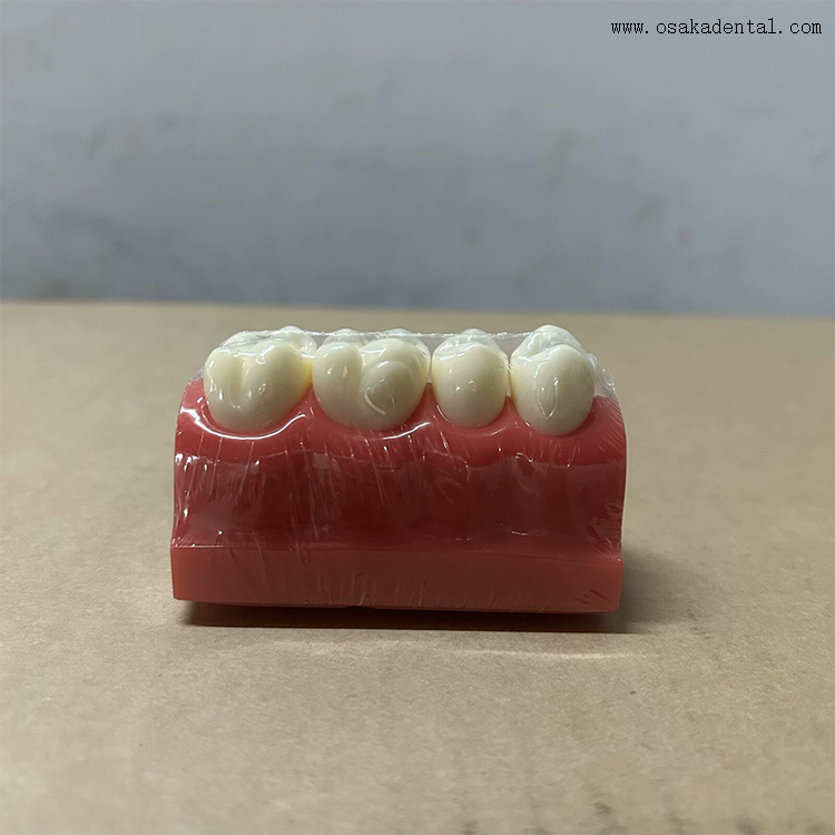 Dental Pit And Fissure Sealant Demonstration Model 