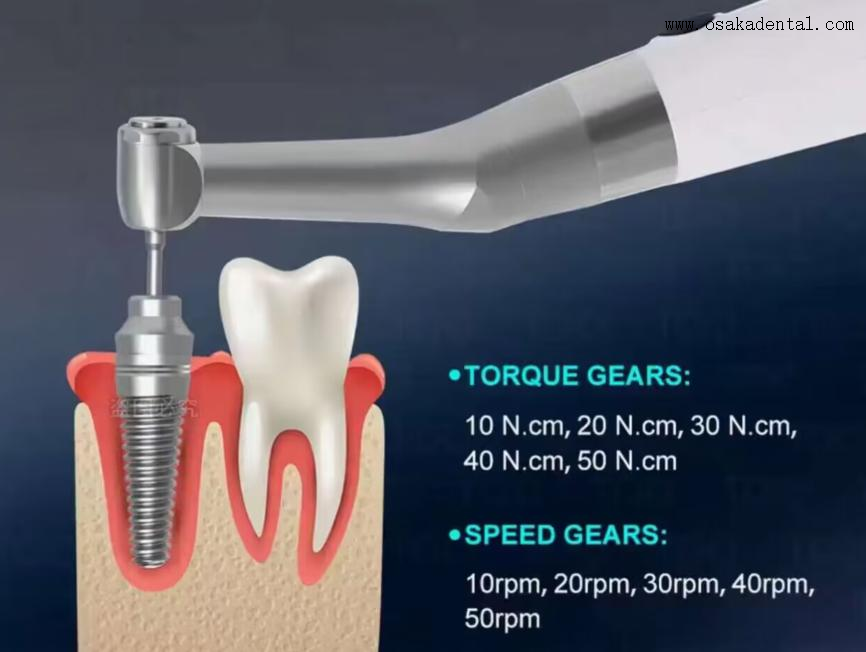 Dental Electric Implant Wrench