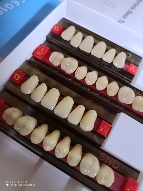 High-Quality Two-Tone Resin Teeth for Natural-Looking Dentures