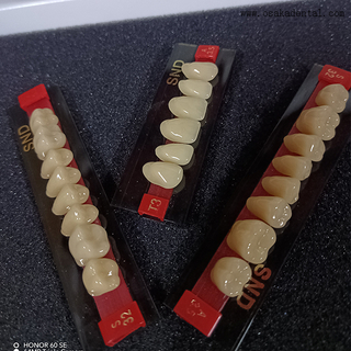 High-Quality Two-Tone Resin Teeth for Natural-Looking Dentures
