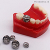 Kid Metal Crown Dental Orthodontic Accessories for Children