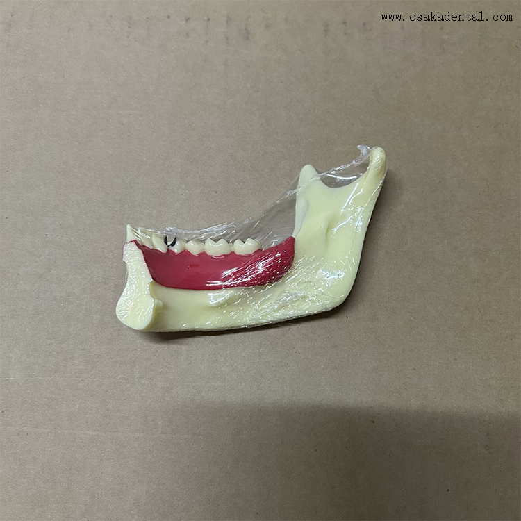 Dental Mandibular Decomposition Teeth Model 