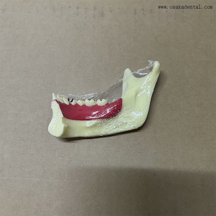 Dental Mandibular Decomposition Teeth Model 