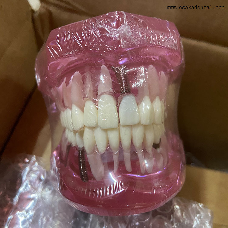 Dental Teeth Implant Model for Dentist Teaching