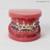 Dental Teeth Orthodontic Model for Dentist Teaching