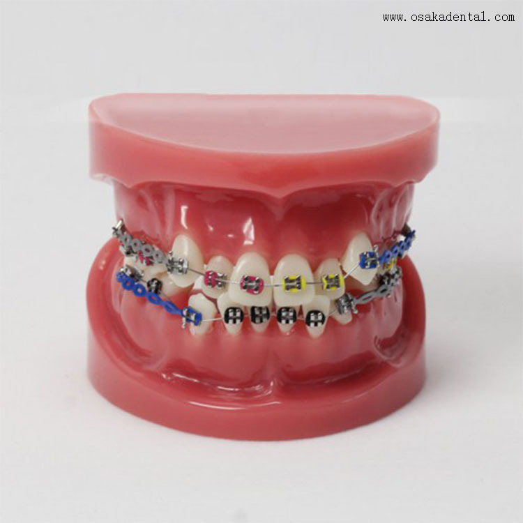 Dental Teeth Orthodontic Model for Dentist Teaching