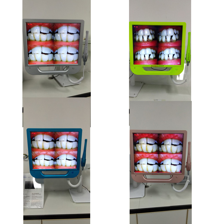A 17 inch Colorful Monitor Dental Intraoral Camera with VGA&VIDEO&USB & WIFI including monitor holder