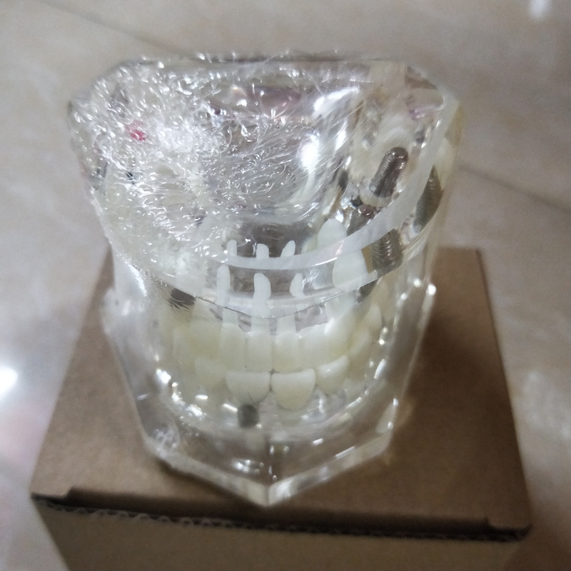 Dental Implant Teaching Model for Student Studying