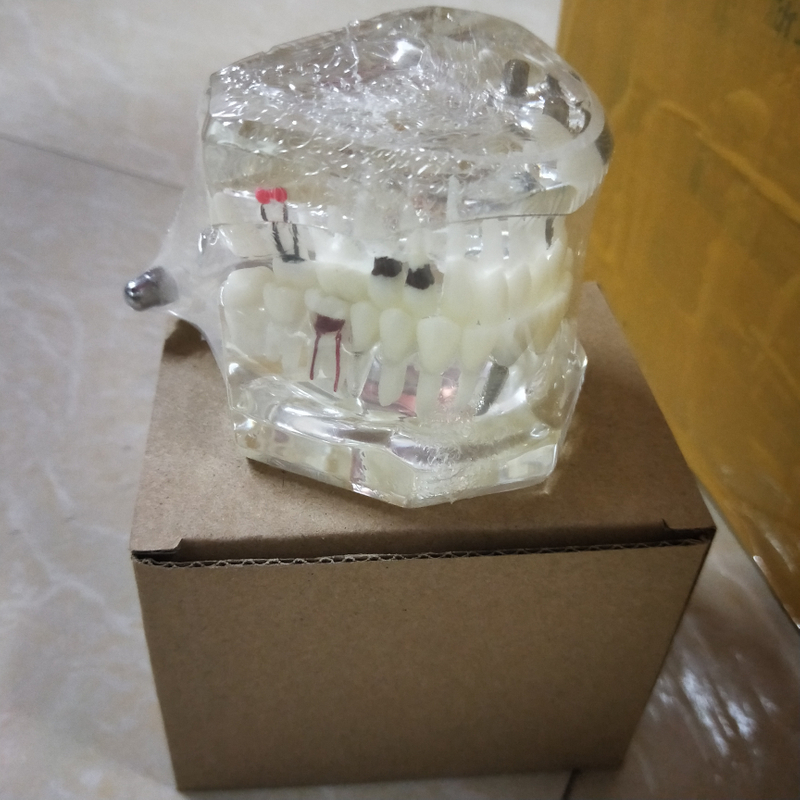 Dental Implant Teaching Model for Student Studying