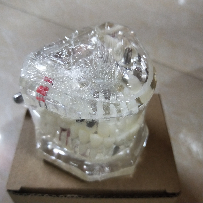 Dental Implant Teaching Model for Student Studying