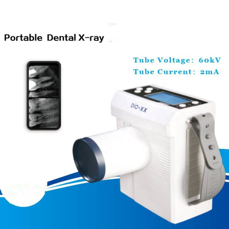 A Korea High Quality Dental Portable Digital X Ray Unit