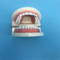 Student Teaching Teeth Model