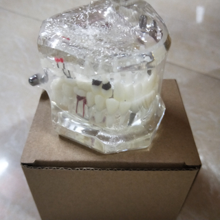 Dental Implant Teaching Model for Student Studying