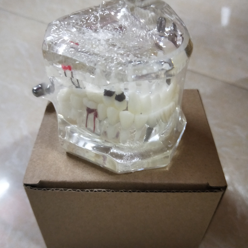 Dental Implant Teaching Model for Student Studying