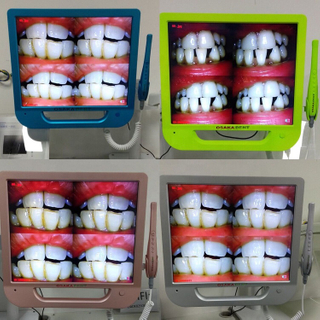 Colourful 17inch monitor +Wifi Dental Intraoral Camera with VGA+VIDEO+US B +monitor holder
