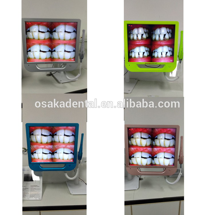 A 17 inch Colorful Monitor Dental Intraoral Camera with VGA&VIDEO&USB & WIFI including monitor holder