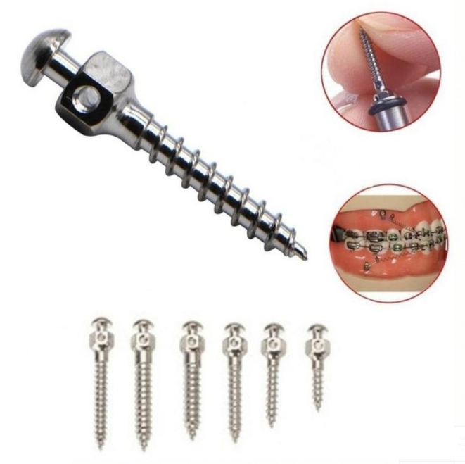 Dental-Orthodontic-Titanium-Alloy-Micro-Implant-Self0